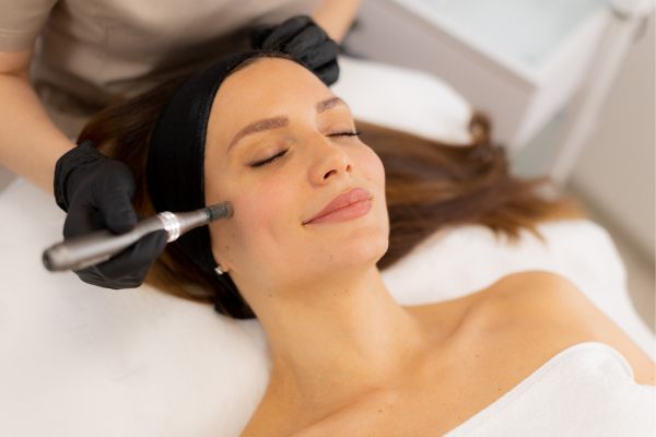 MICRONEEDLING AT THE BEST SALON IN LEEDS
